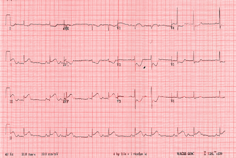 ecg7