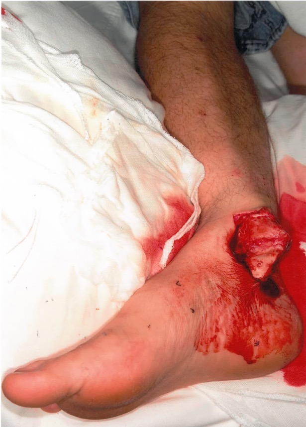 Ankle injury photograph for Geelong SAQ 008 question 9