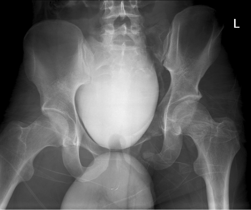 Pelvic X-ray with retrograde cystogram for Geelong SAQ 010 question 2