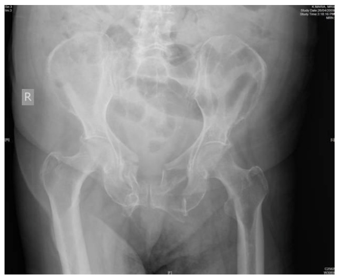 Pelvis x-ray for Geelong SAQ 012 question 2