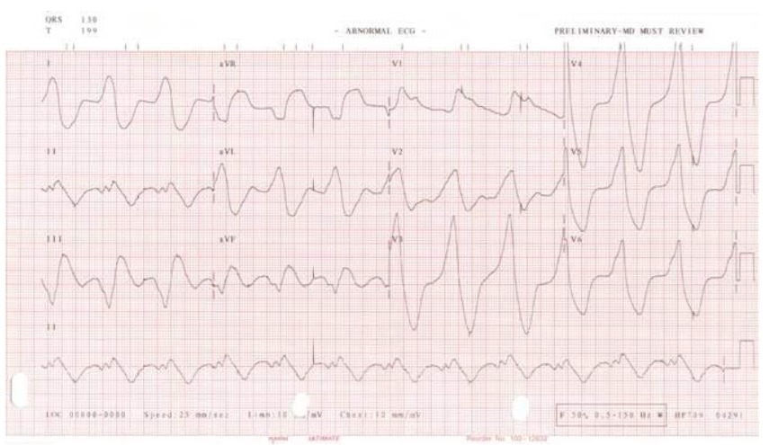 ECG for Geelong SAQ 012 question 5