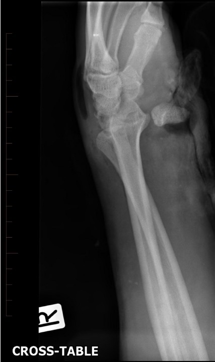 Wrist x-ray lateral for Geelong SAQ 013 question 3
