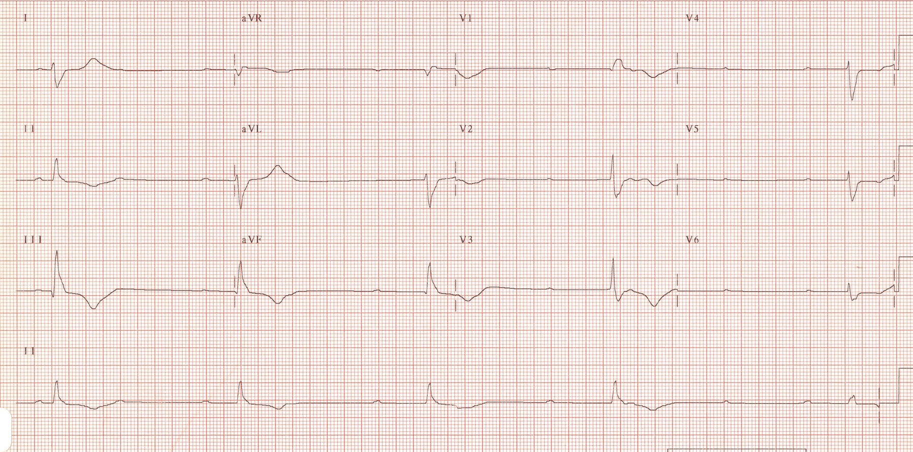ECG 2 for Geelong SAQ 015 question 4