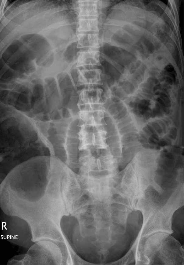 Abdominal x-ray for Geelong SAQ 016 question 6