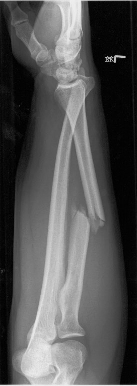 Left forearm x-ray for Geelong SAQ 016 question 8