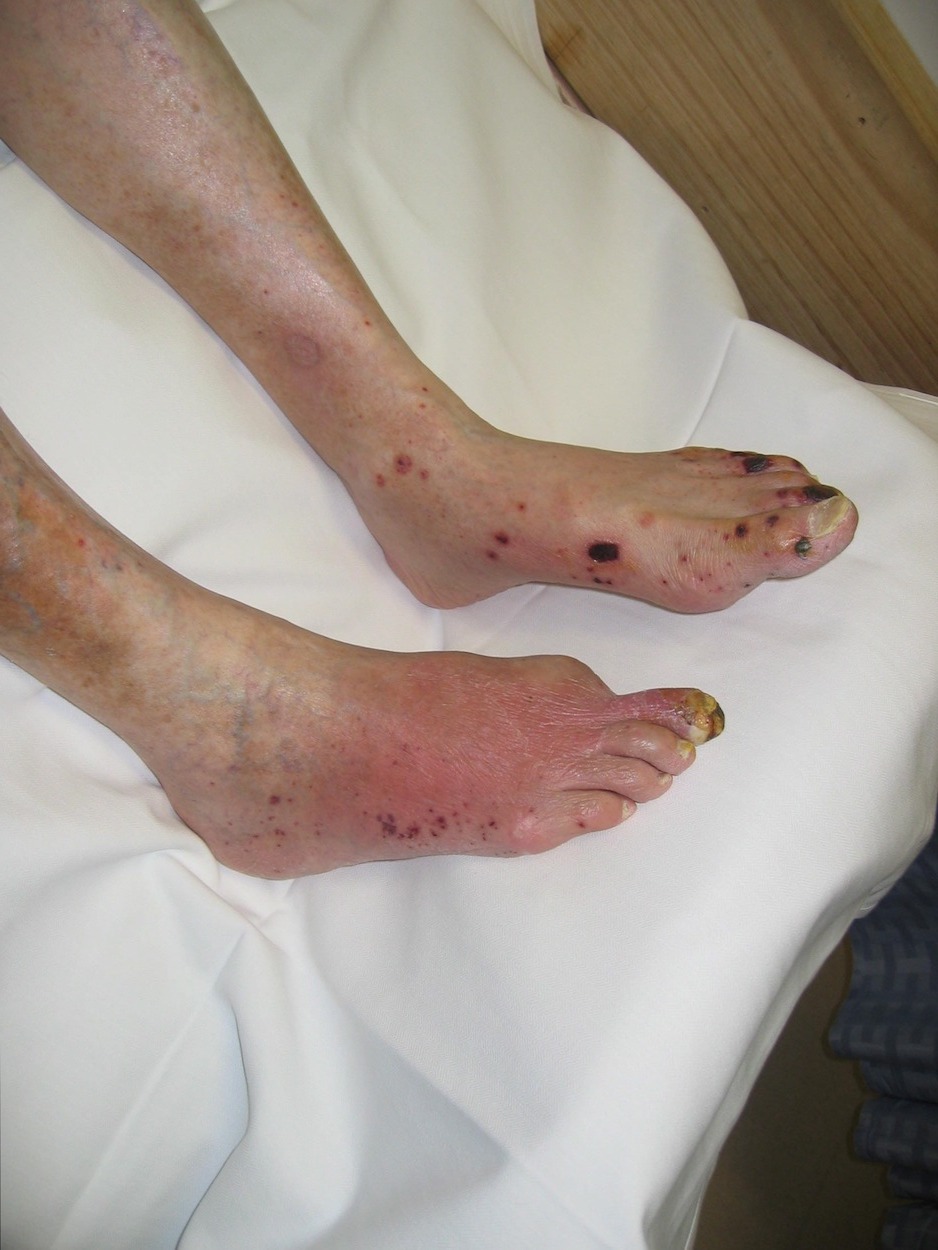 Photograph of painful feet for Geelong SAQ 017 question 4