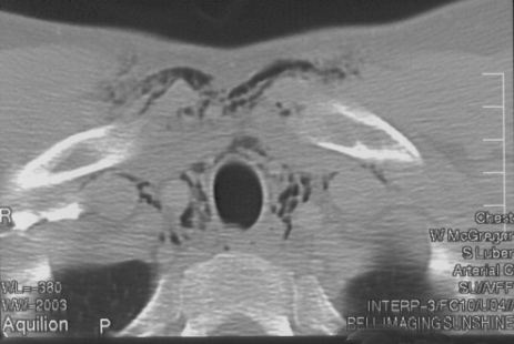 CT neck slice 2 for Geelong SAQ 019 question 6