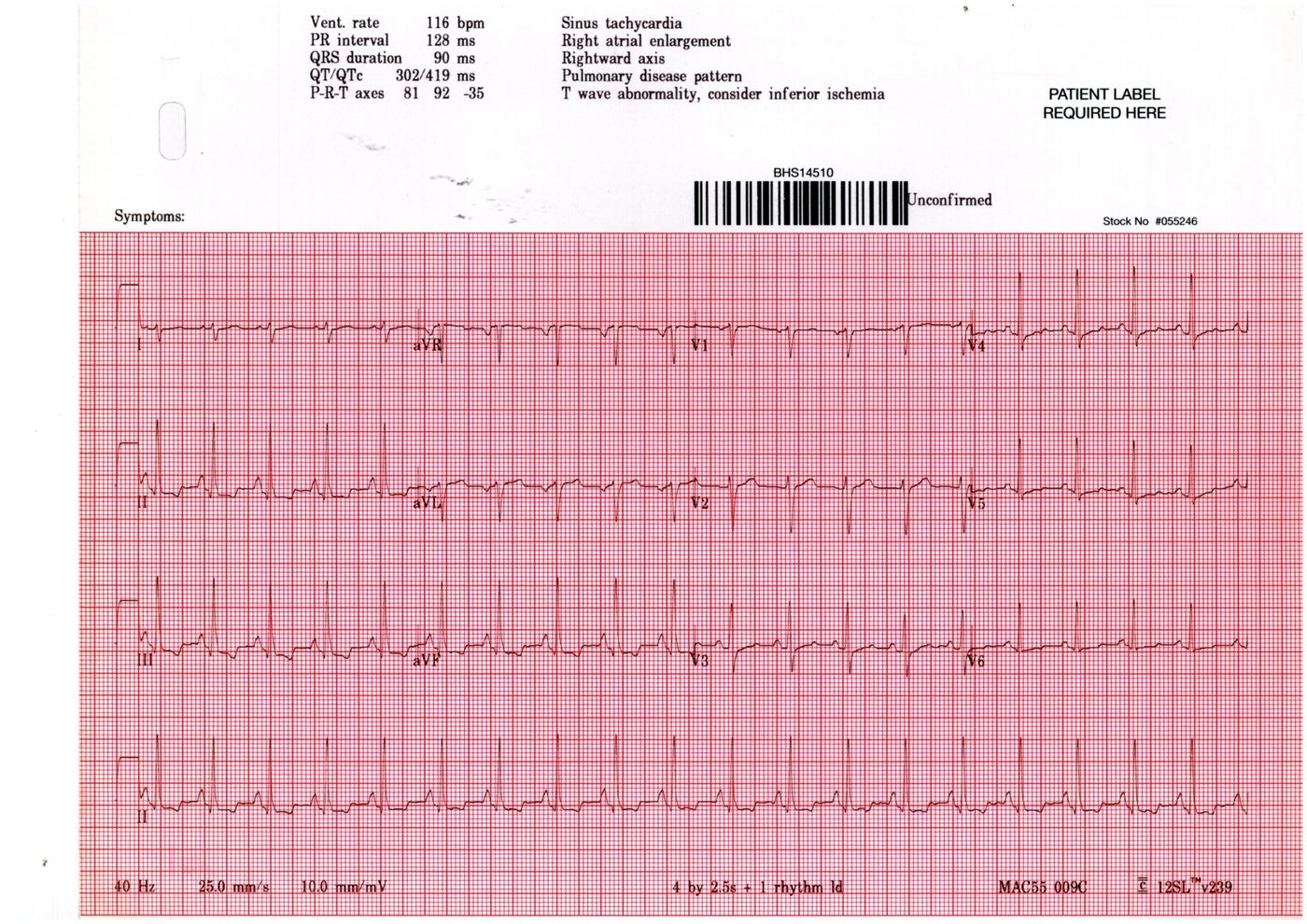 ECG for Geelong SAQ 020 question 1