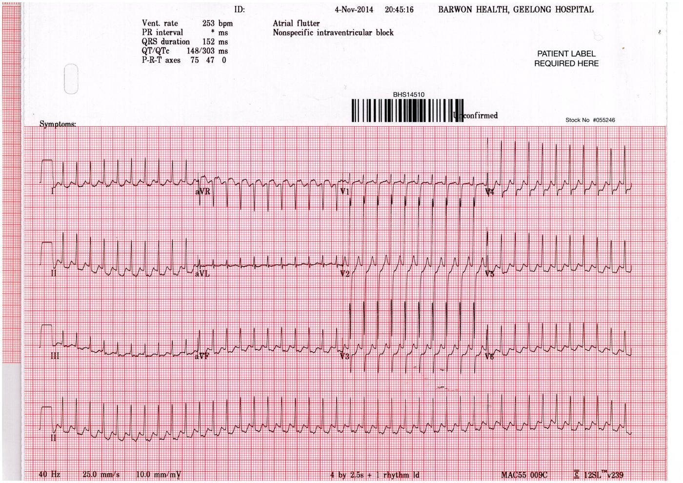 ECG for Geelong SAQ 021 question 9
