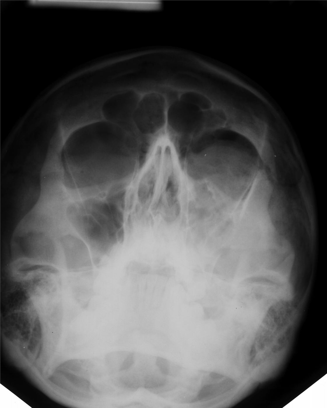 Facial x-ray for Geelong SAQ 022 question 2