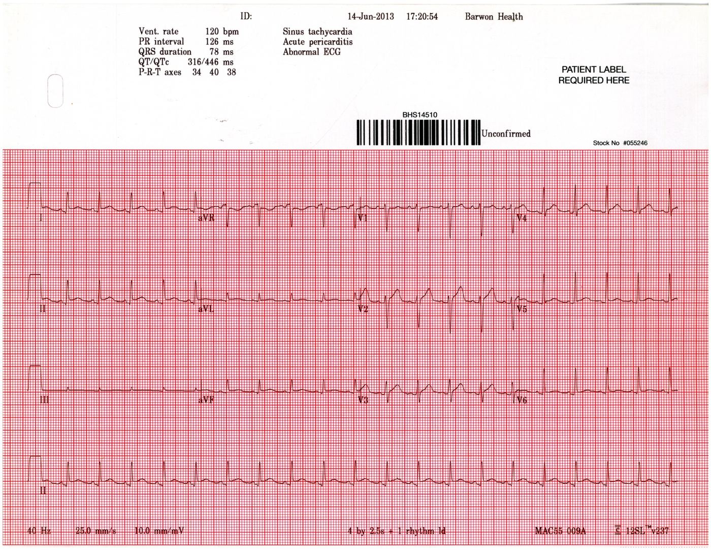 ECG for Geelong SAQ 025 question 4
