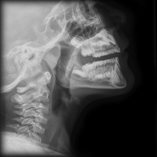 Lateral neck x-ray for Geelong SAQ 026 question 3