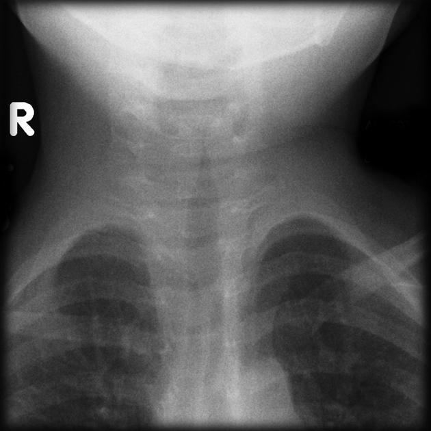 AP neck x-ray for Geelong SAQ 026 question 3