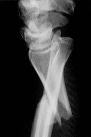 Lateral left forearm x-ray for Geelong SAQ 028 question 3