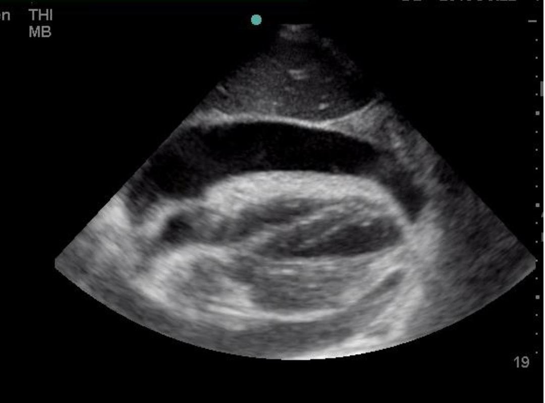 Cardiac ultrasound for Geelong SAQ 028 question 8