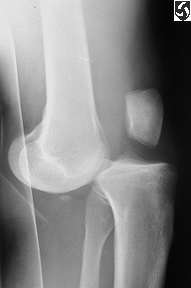 Knee x-ray for Geelong SAQ 030 question 5
