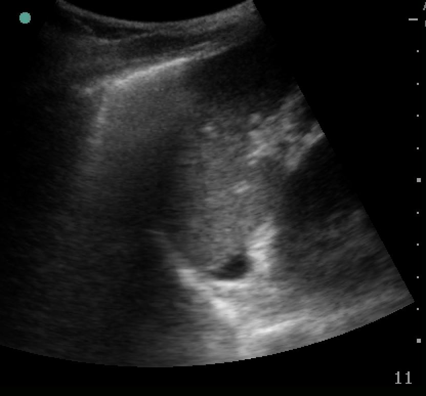 FAST left upper quadrant image.