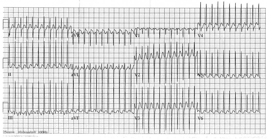 Twelve-lead ECG from a lethargic 4-week-old infant.