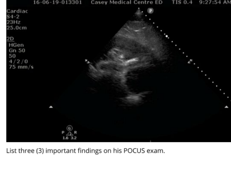 Resuscitation cardiac POCUS image.