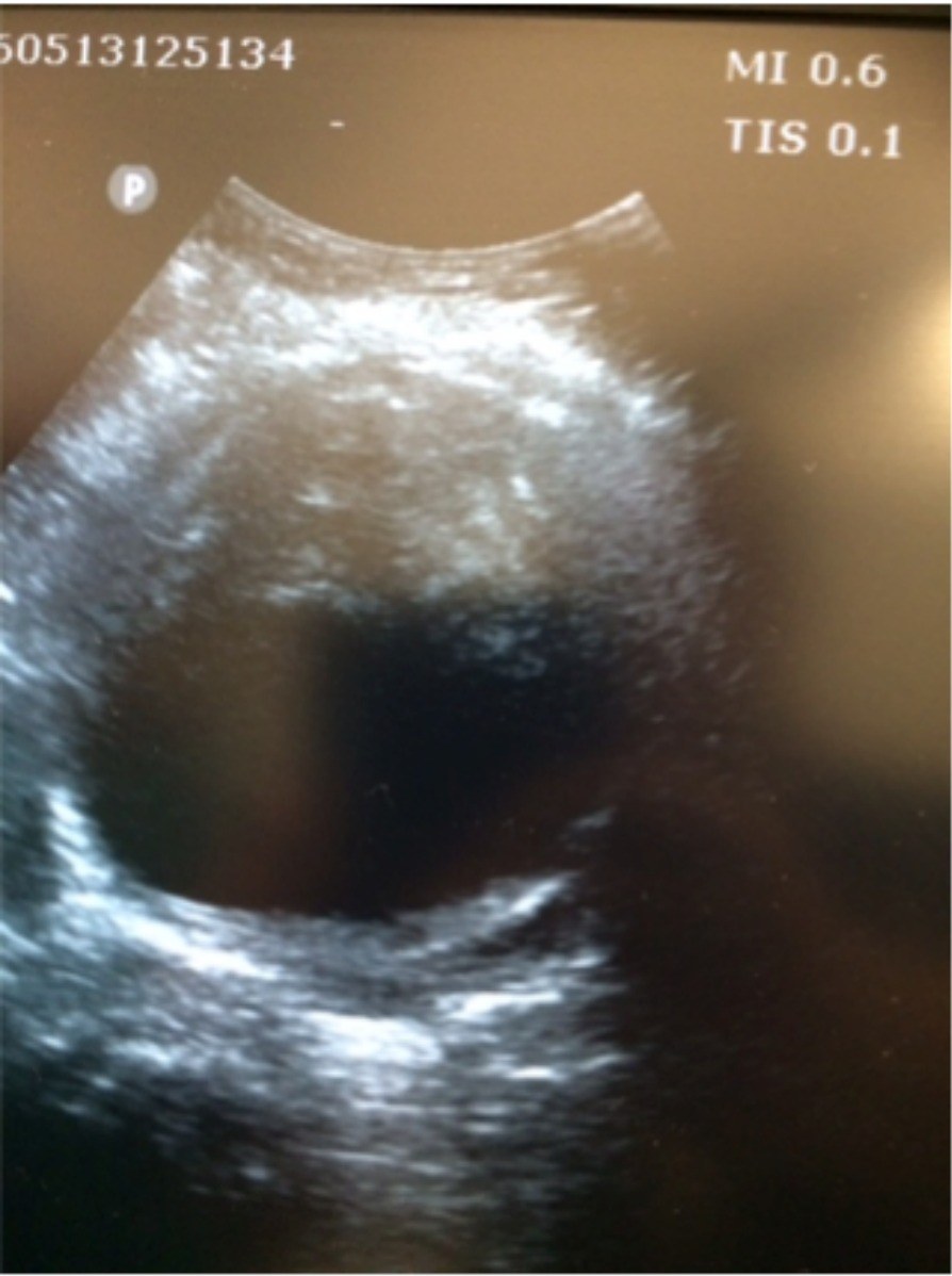 Bedside abdominal ultrasound image.