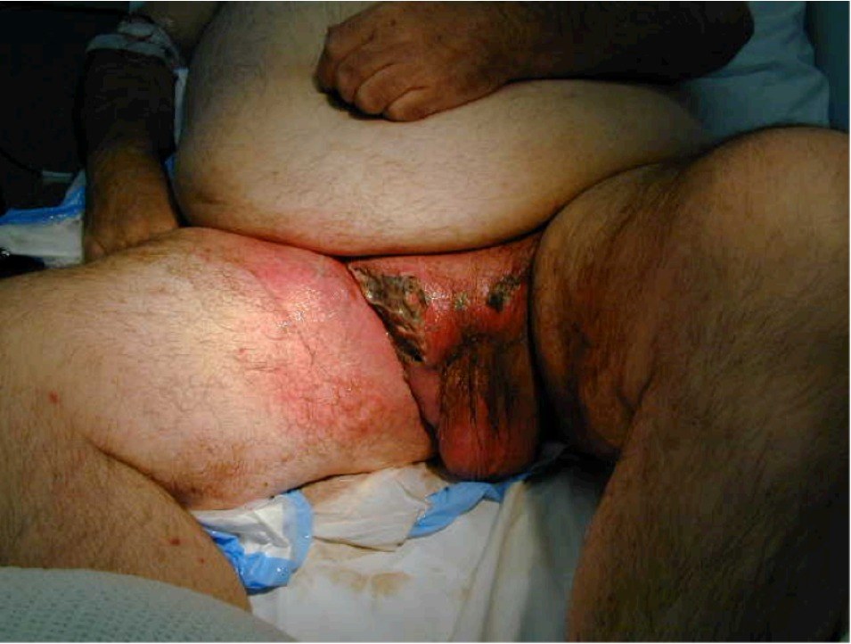 Clinical image of the affected region.