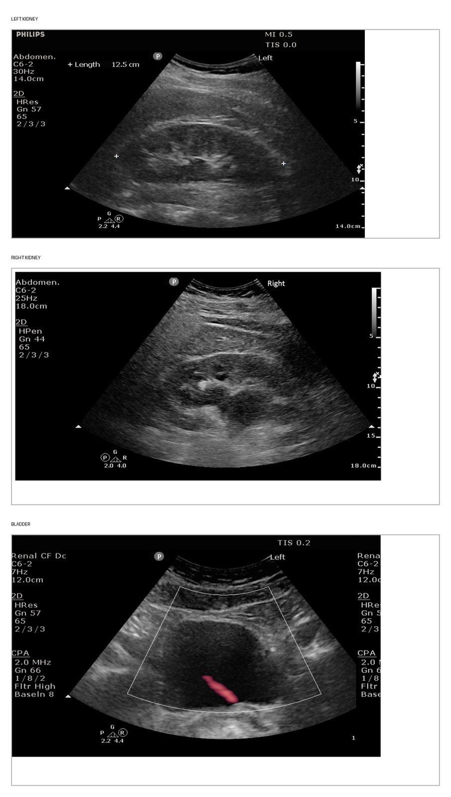 Renal and bladder POCUS images.