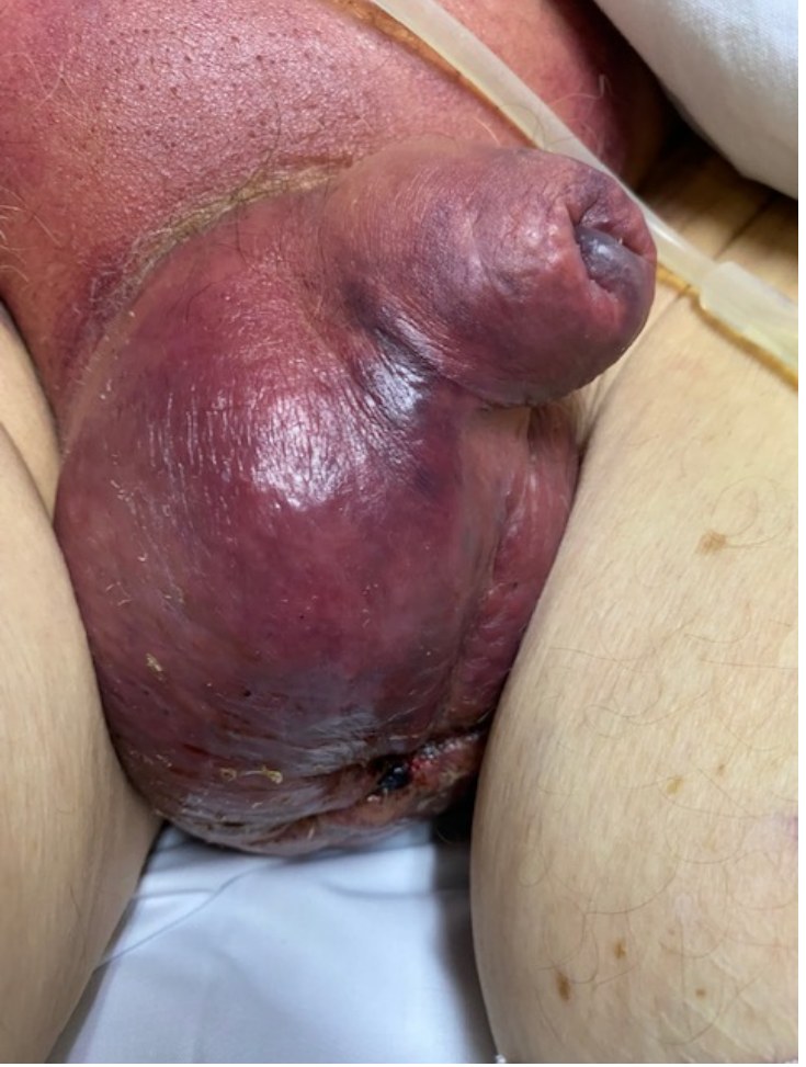 Clinical image.