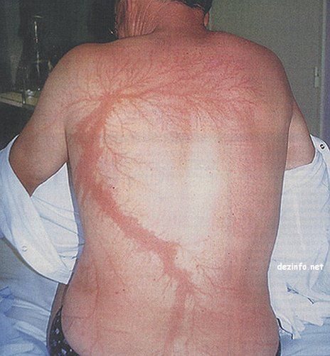 Back photograph after outdoor collapse
