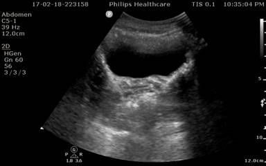 Paediatric FAST ultrasound image 2