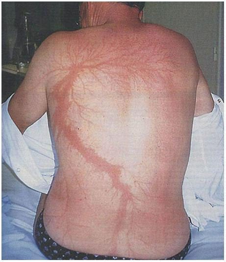 Skin finding after collapse outdoors
