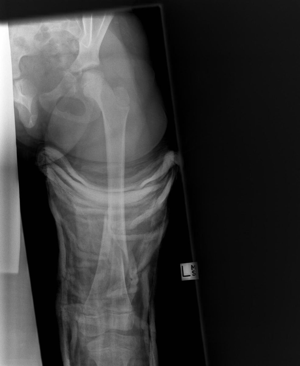 X-ray of the injured leg