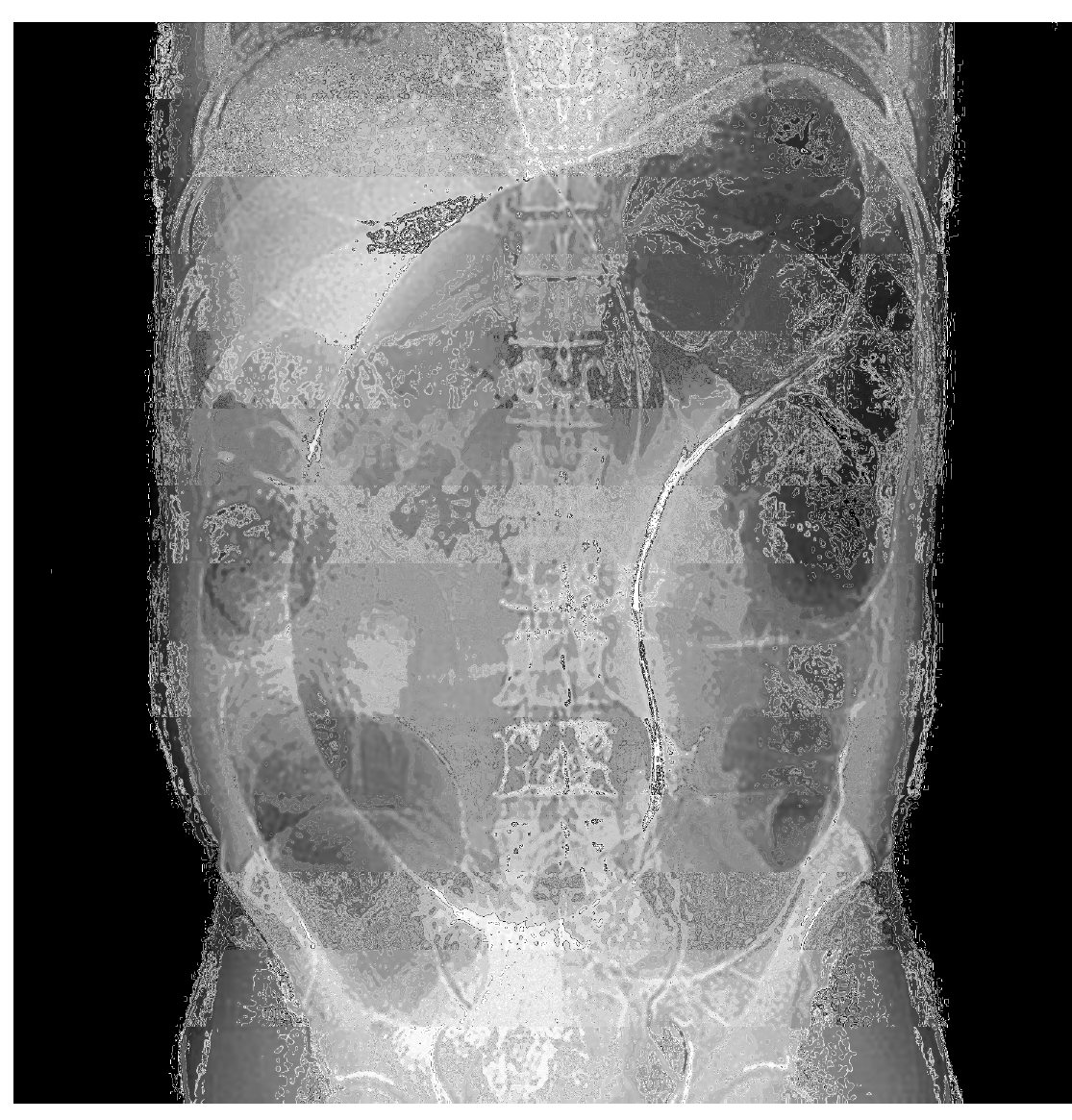 Abdominal X-ray for an older nursing-home resident with abdominal pain