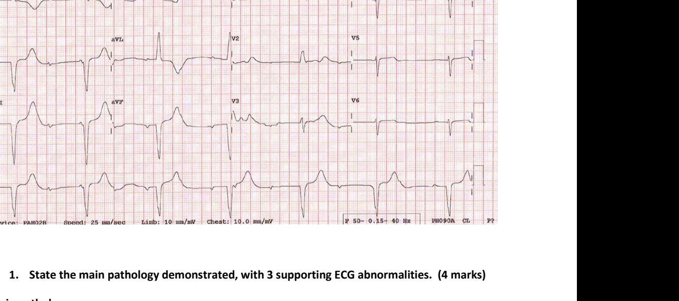 Arrival ECG after syncope