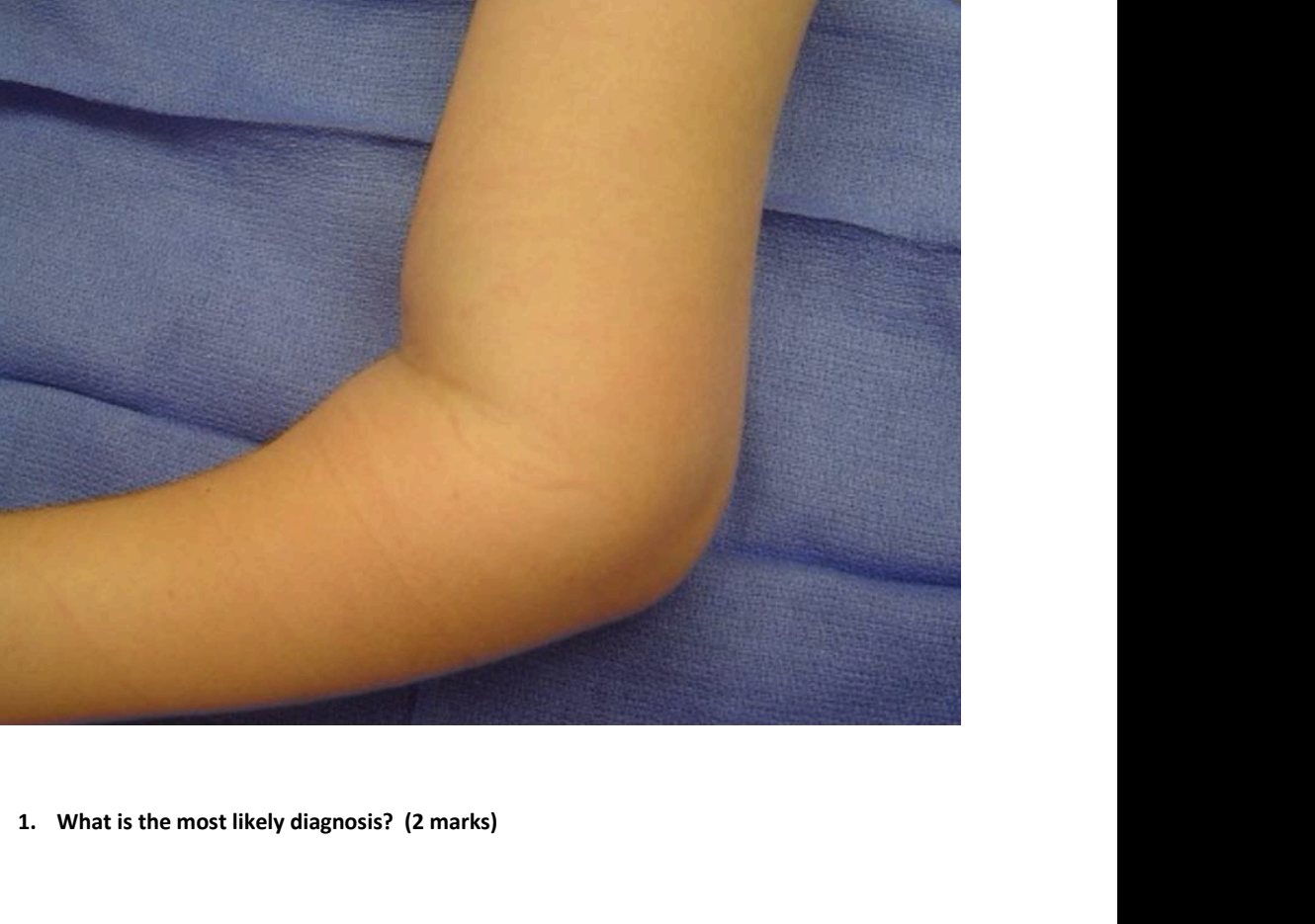 Clinical photograph of a child left arm after fall