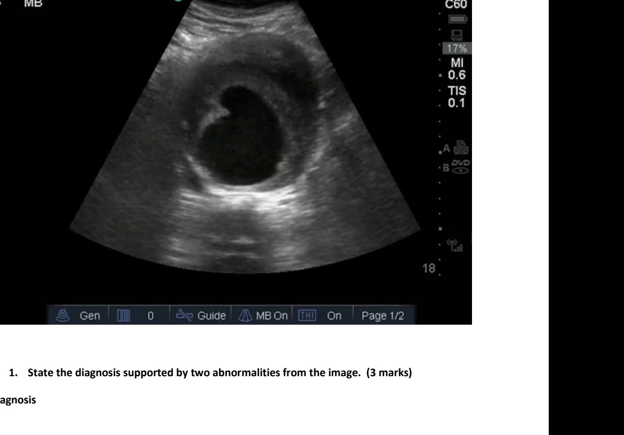 Bedside abdominal ultrasound in older patient with collapse