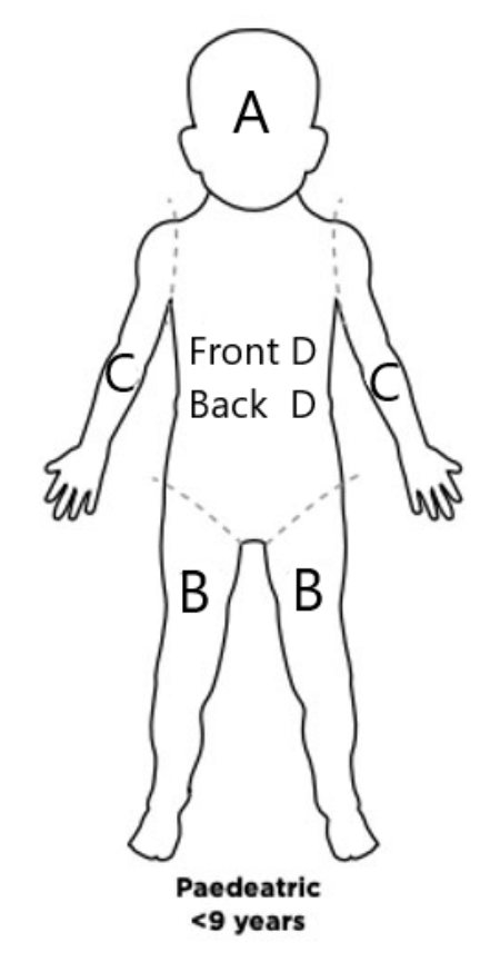 Paediatric burn surface area diagram labelled A, B, C and D