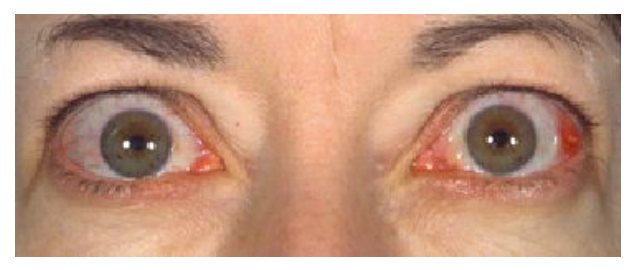 Clinical photograph from the source question
