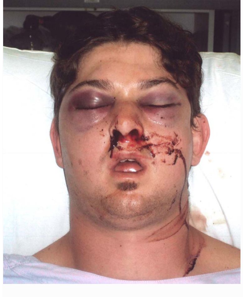 Clinical photograph from the source question after facial injury