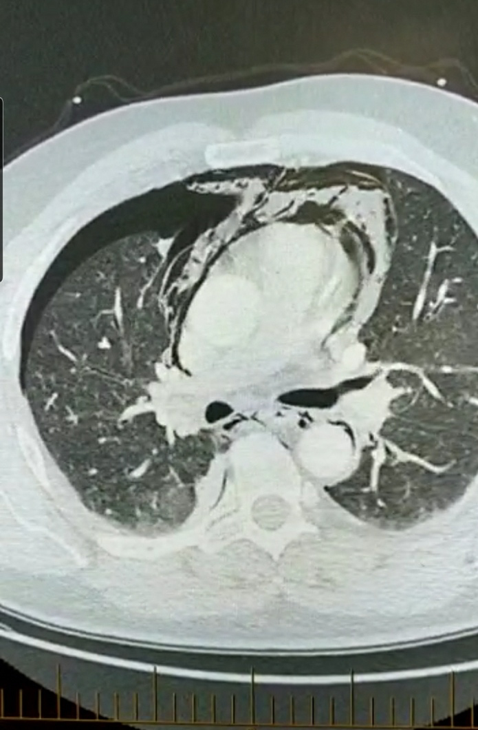 CT chest and abdomen image 1